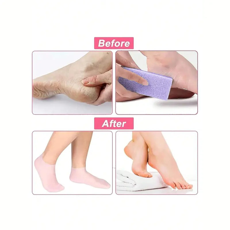 جرابات سيليكون مرطب للقدم – علاج جفاف وكعب ناعم